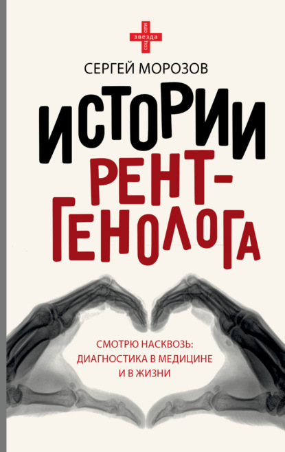 История рентгенолога. Смотрю насквозь: диагностика в медицине и в жизни