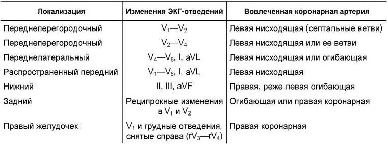 Экг отведения отвечают за какую стенку