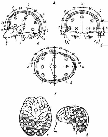 Схема 10. ЭЭГ схема 10-10. Схема расположения электродов при ЭЭГ 10-20. Схема ЭЭГ 10-20. ЭЭГ наложение электродов схема 10-20.